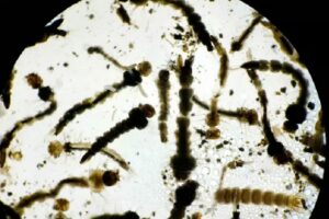 El dengue es una infección viral que se transmite al ser humano exclusivamente a través de la picadura del mosquito Aedes aegypti, que es el vector de la enfermedad